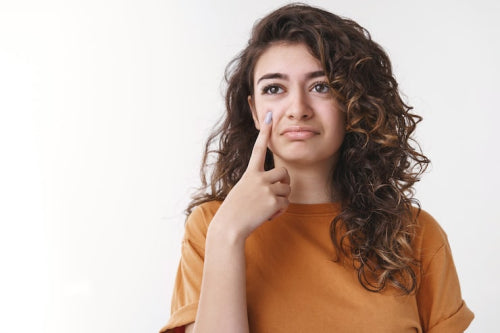 What to Know About Acne-Prone Skin Care
