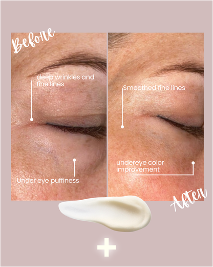 Radiance Renewal Eye Cream + NMF Complex