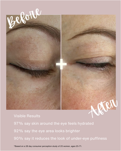 Radiance Renewal Eye Cream + NMF Complex